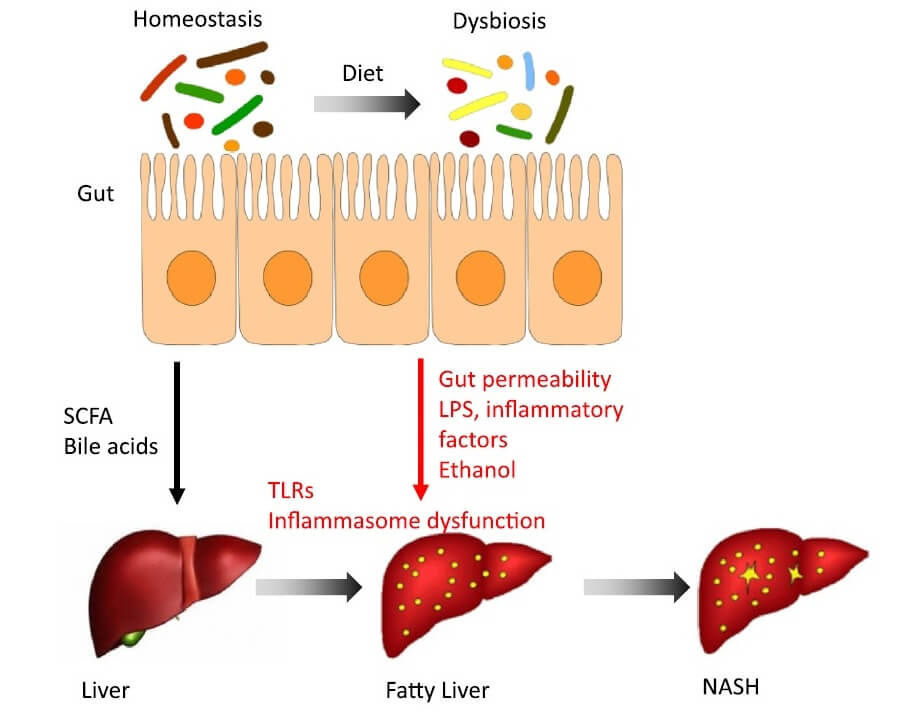 Gut-liver axis Essentials Fig 3