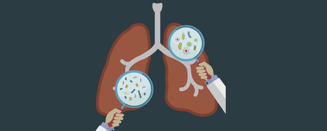 Gut-lung axis Essentials
