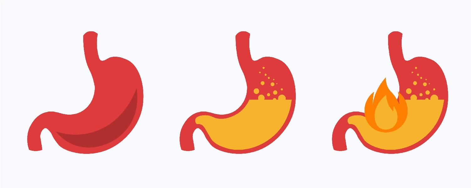 Western diet and gut inflammation