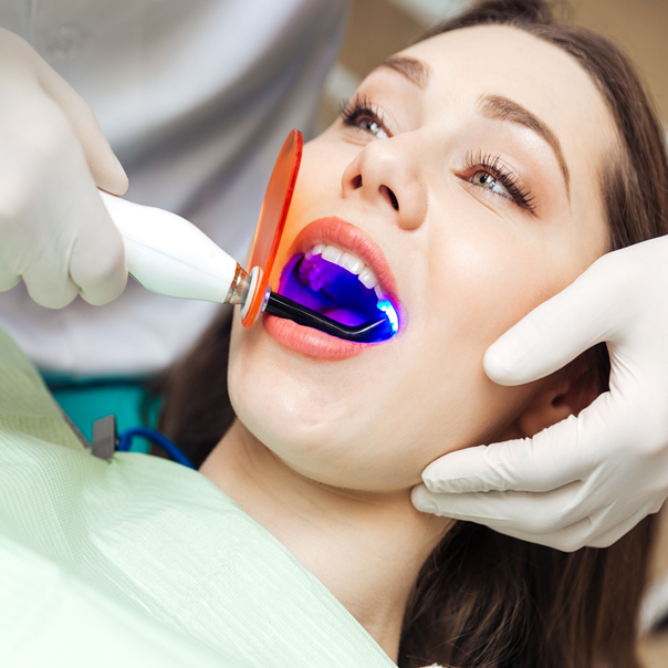 Tooth whitening procedures and products